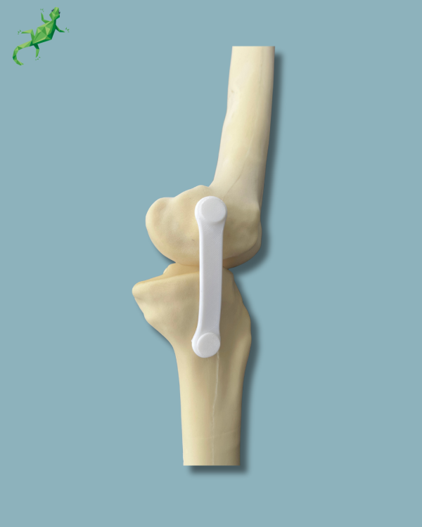 Knee / Medium / Left / Addi-CAN with intramedullar canal - Ref 04-31-01 - Image 7