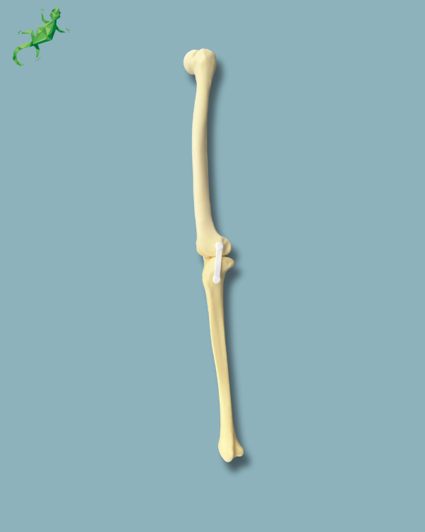 Knee / Medium / Left / Addi-CAN with intramedullar canal - Ref 04-31-01 - Image 4