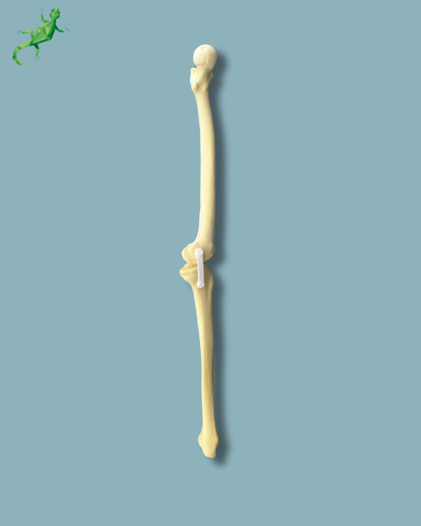 Knee / Medium / Left / Addi-CAN with intramedullar canal - Ref 04-31-01 - Image 3