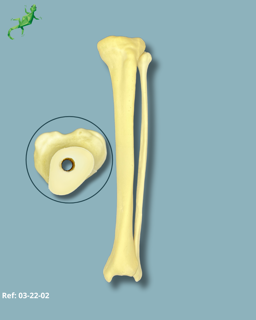 Tibia and Fibula / Addi-CAN with intramedullar canal – Ref 03-22-02