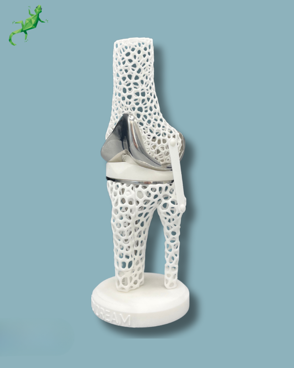Présentoir Genou Premium Lattice avec capot - Ref 04-AL-01 – Image 11