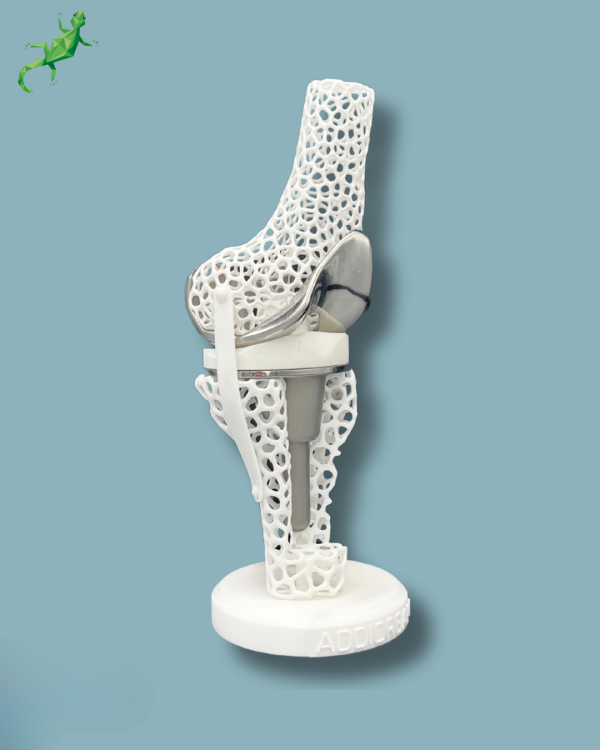 Présentoir Genou Premium Lattice avec capot - Ref 04-AL-01 – Image 4