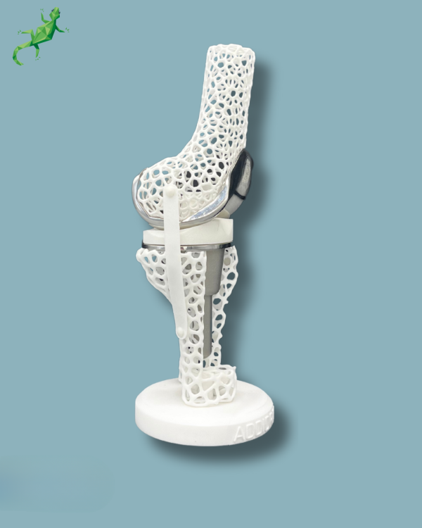 Display Knee Premium Lattice with Cover – Ref 04-AL-01 - Image 8