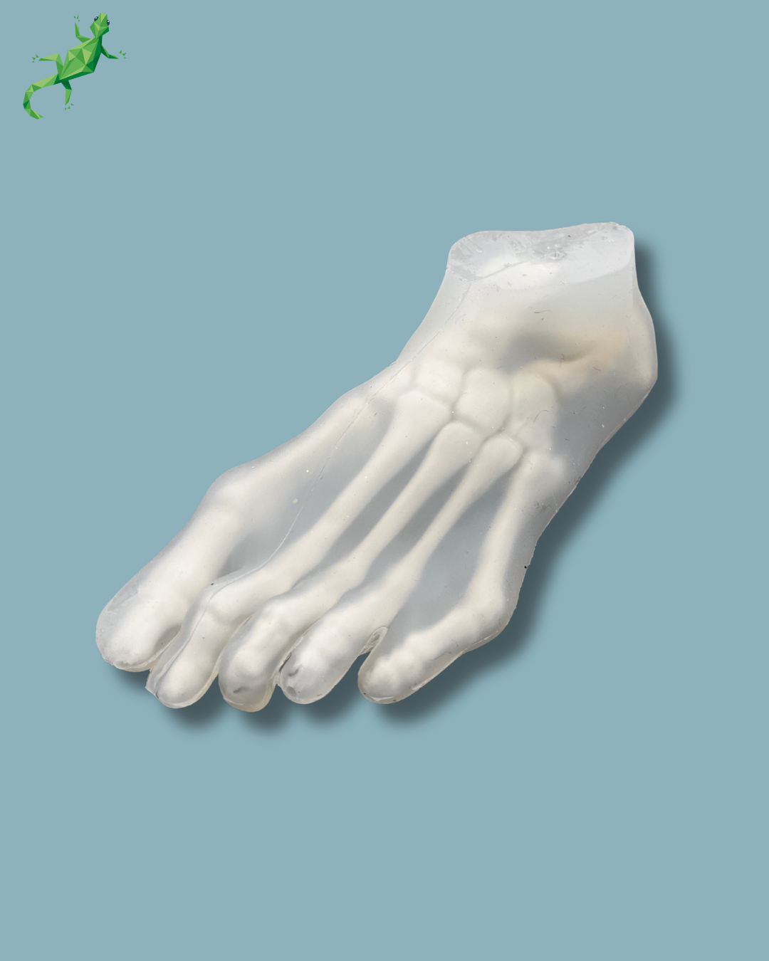 Transparent Foot with deformity, left – Ref 01-47-01