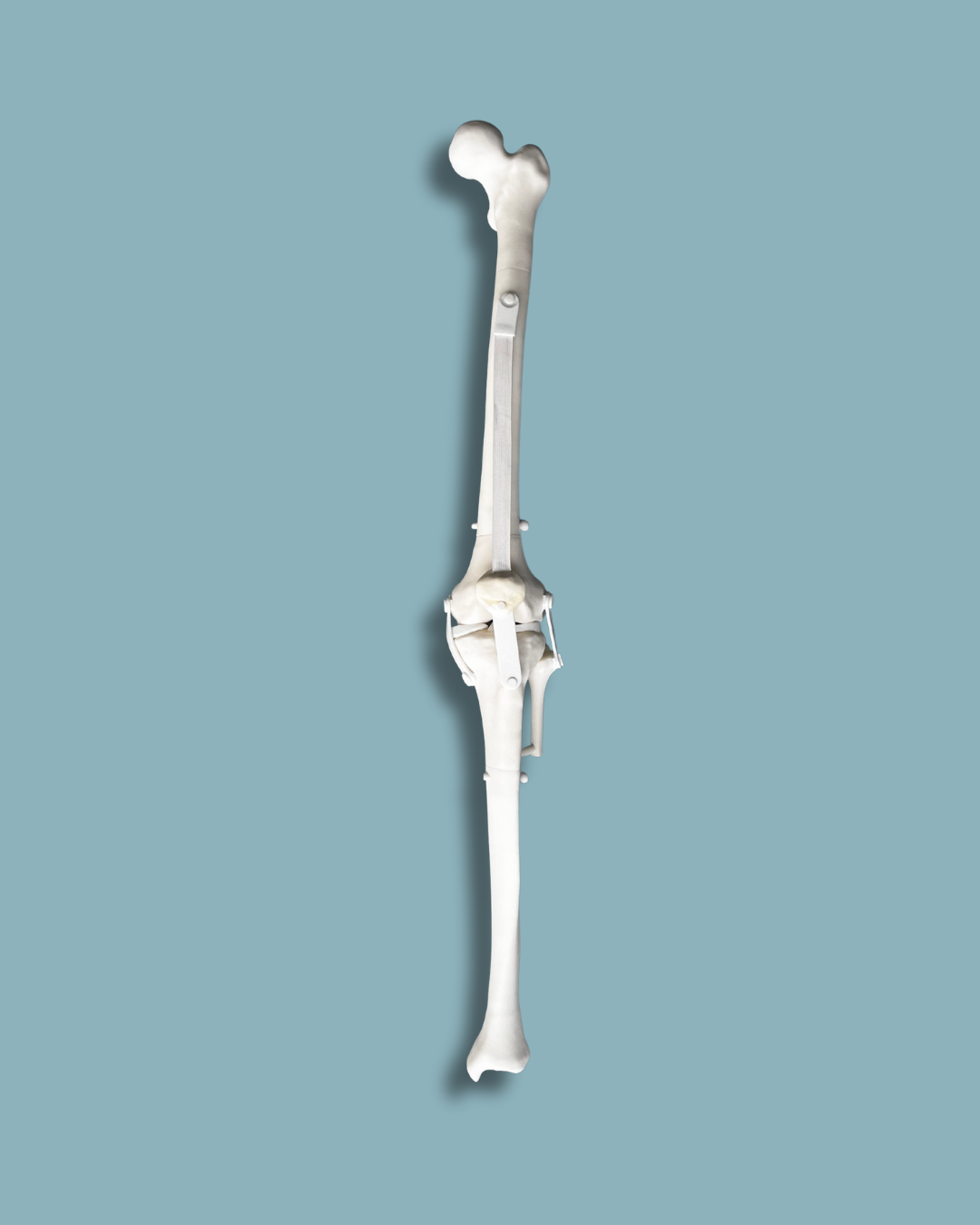 Knee arthroscopy, left – Ref 04-36-01